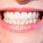 Aktualna technologia używana w salonach stomatologii estetycznej zdoła spowodować, że odbierzemy śliczny uśmiech.